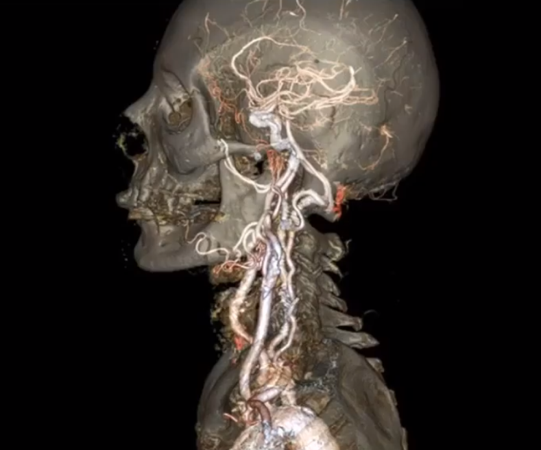 image-20210115174731069